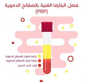 prp-plasma-for-website